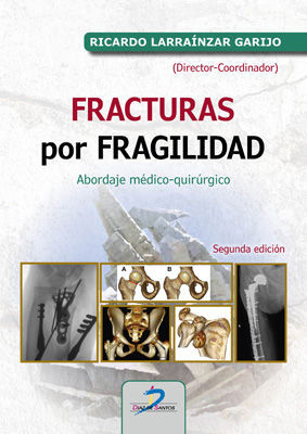 FRACTURAS POR FRAGILIDAD:ABORDAJE MEDICO QUIRURGICO